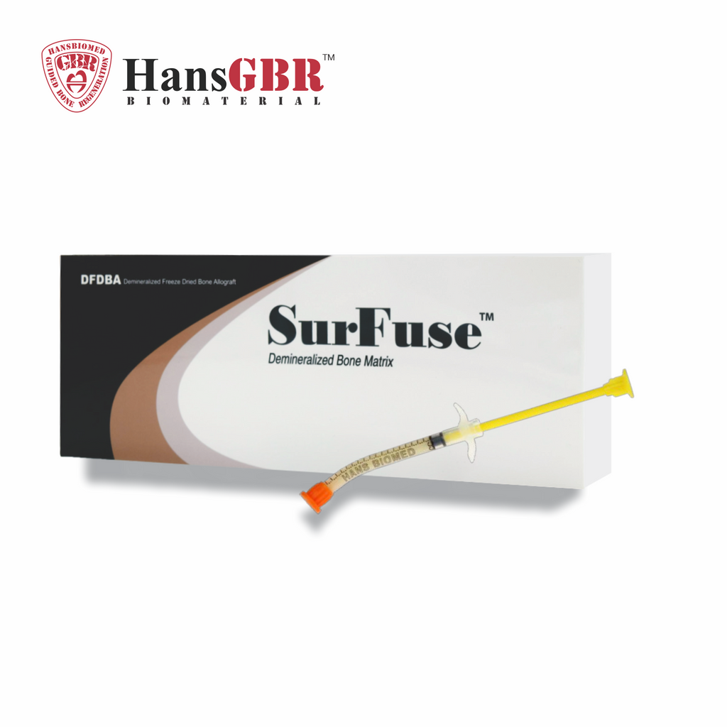 SurFuse Demineralized Freeze Dried Bone Allograft Matrix syringe 